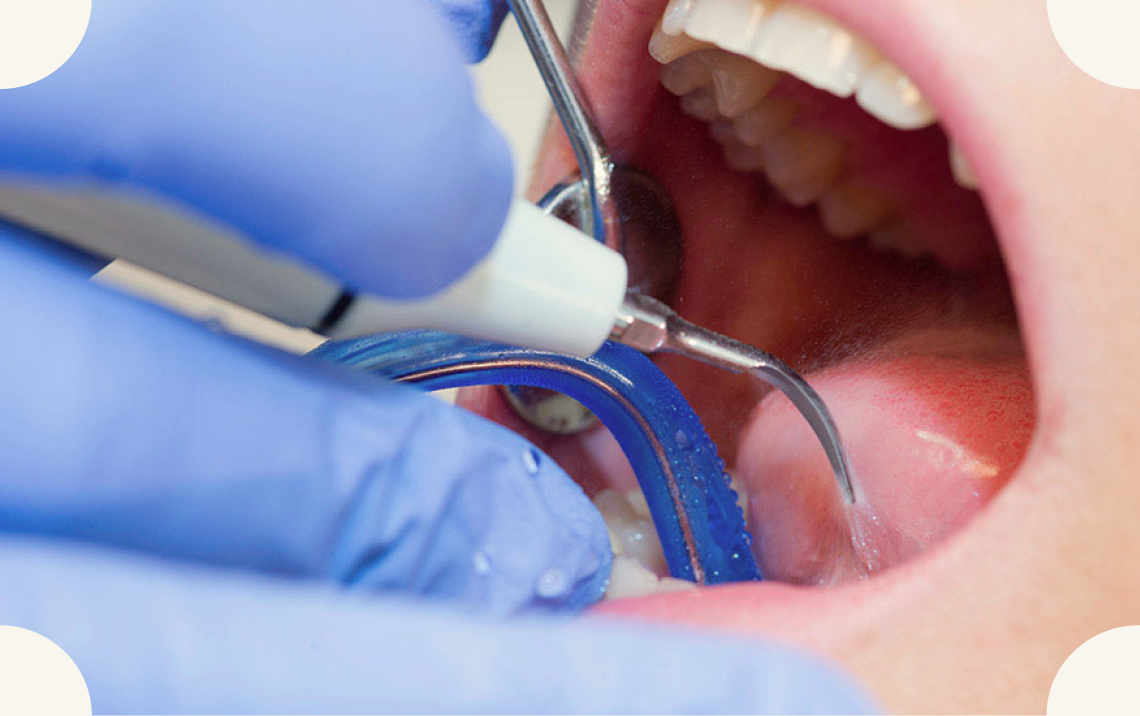 予防を重視した将来設計型の歯科医療